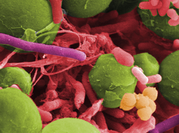 C'è del buono nella CO2 (basta saperla prendere)