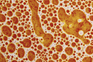 Reconnecting With the Original Value of Food Through Fermentation